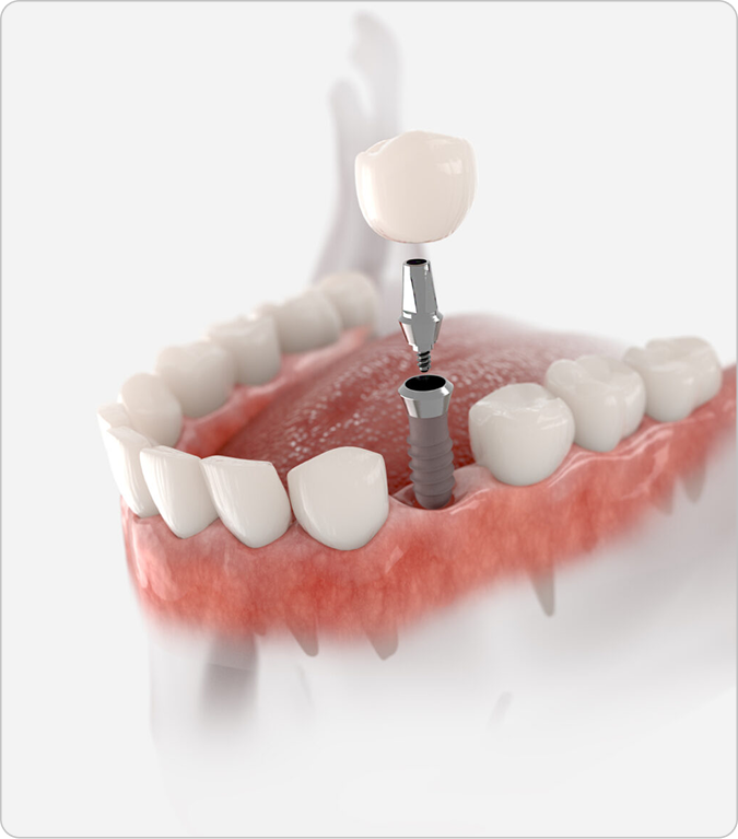 Restorative Dentistry